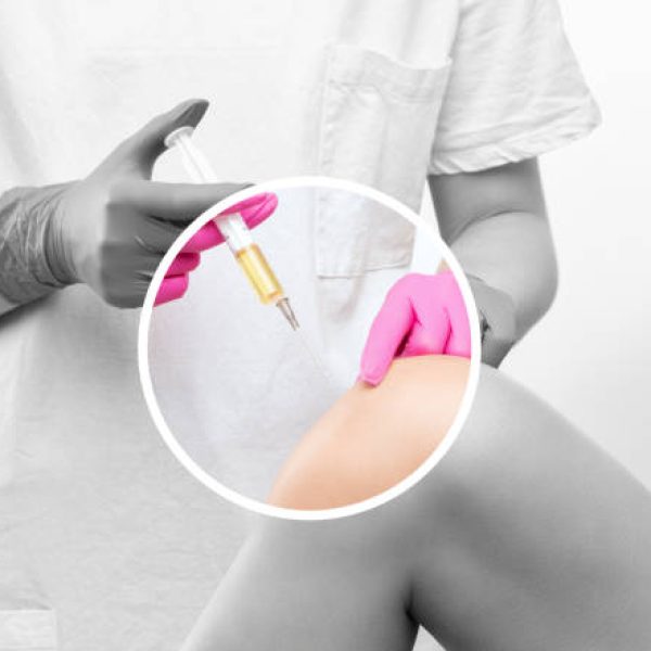 Doctor doing stem cell therapy on a patient's knee after the injury. Treating knee pain with platelet-rich plasma injection. Treatment of arthritis and osteoarthritis.Medical and cosmetology concept.